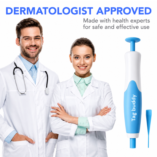 TagBuddy™ | Skin Tag Remover Kit