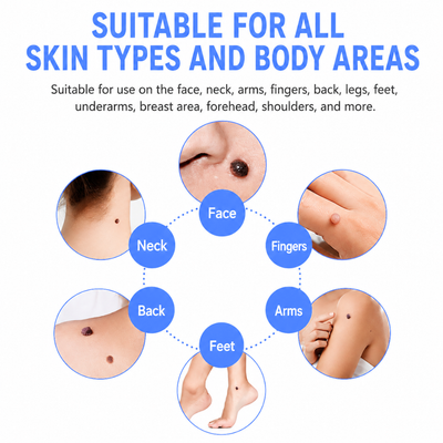 TagBuddy™ | Skin Tag Remover Kit